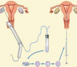 35岁女性备孕请做好以下检查，“健康西安代生宝宝”跑不远